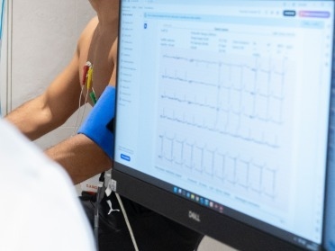 Prova da Sforzo_image