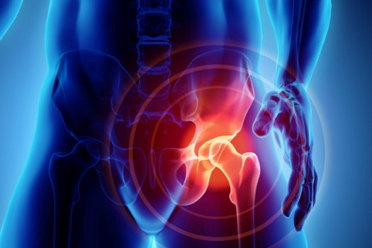 Parliamo di prevenzione dell’artrosi all’anca